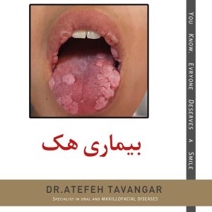 بیماری هک