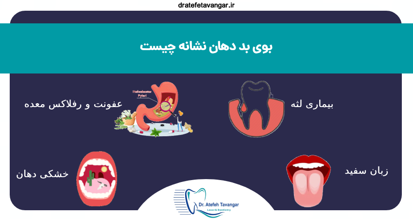 بوی بد دهان نشنانه چیست