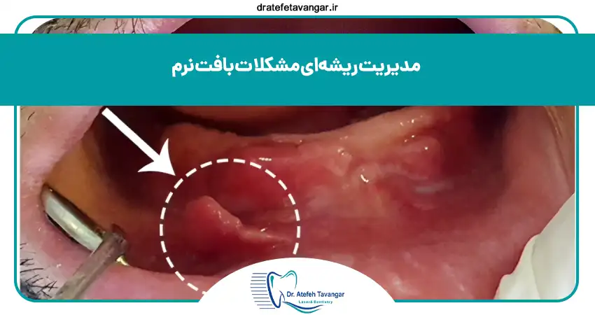 مدیریت ریشه ای مشکلات بافت نرم