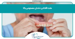علت افتادن دندان مصنوعی بالا
