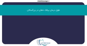 طول درمان برفک دهان در بزرگسالان