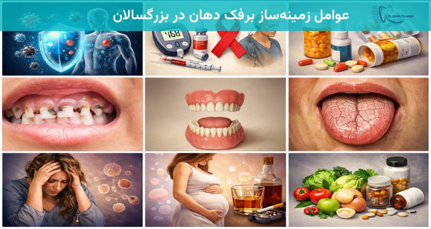 عوامل زمینهساز برفک دهان در بزرگسالان