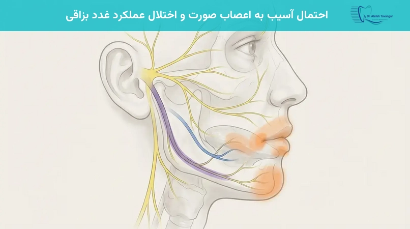 احتمال آسیب به اعصاب صورت و اختلال عملکرد غدد بزاقی