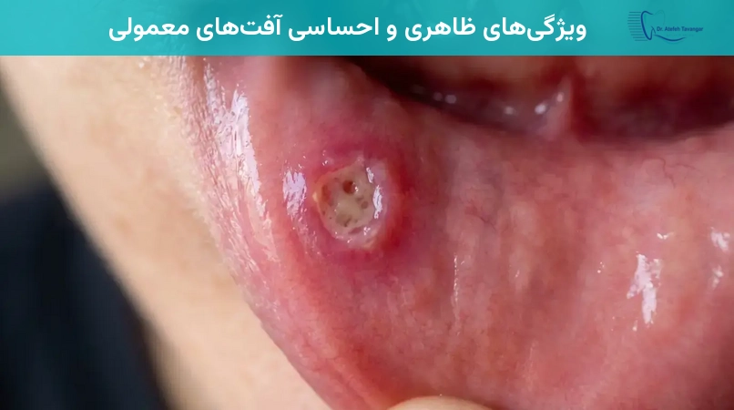 ویژگیهای ظاهری و احساسی آفتهای معمولی