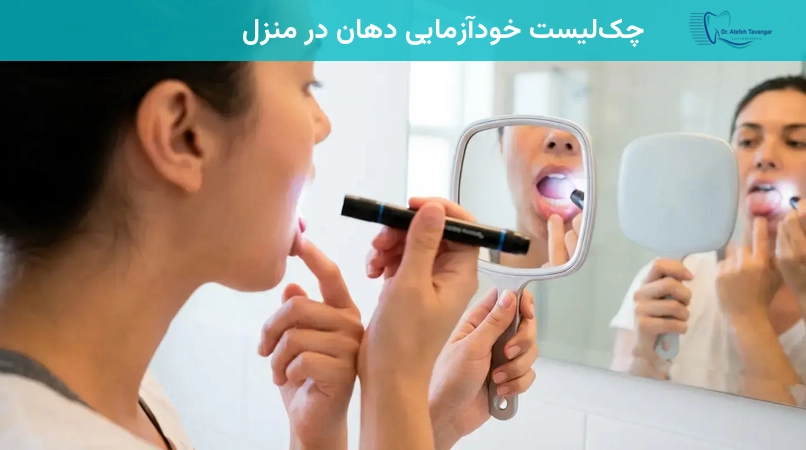 چکلیست خودآزمایی دهان در منزل