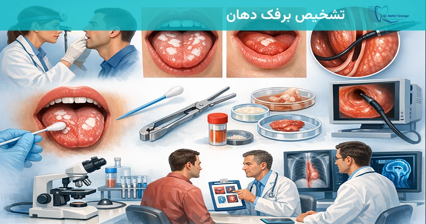 تشخیص برفک دهان