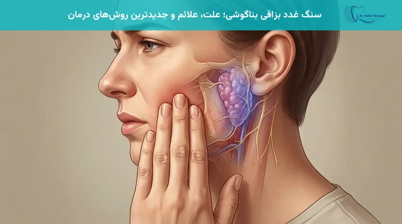 سنگ غدد بزاقی بناگوشی؛ علت، علائم و جدیدترین روشهای درمان