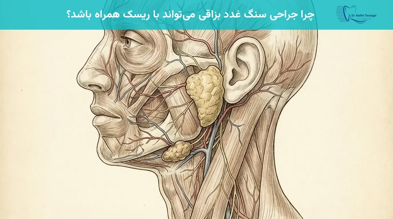 چرا جراحی سنگ غدد بزاقی میتواند با ریسک همراه باشد؟