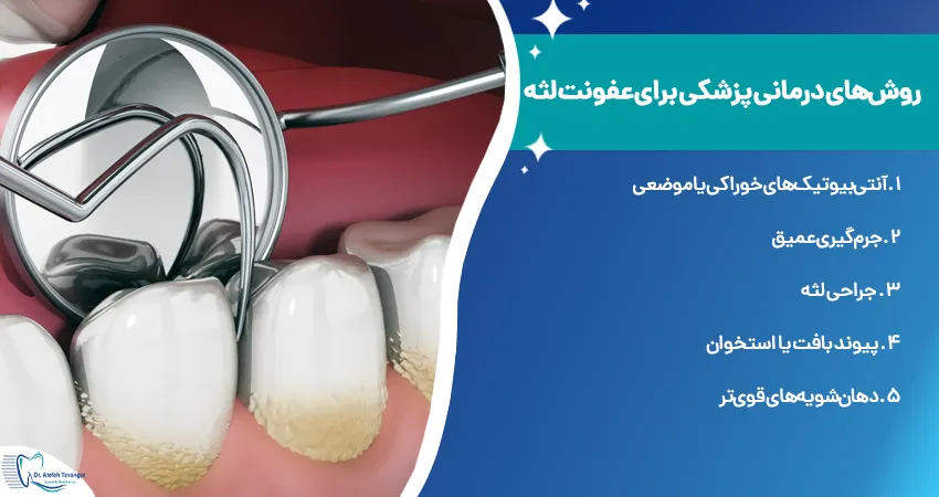 روش های درمانی پزشکی برای عفونت لثه