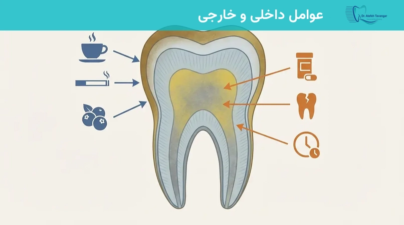 عوامل داخلی و خارجی