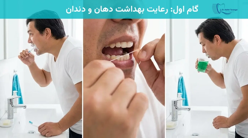 گام اول: رعایت بهداشت دهان و دندان