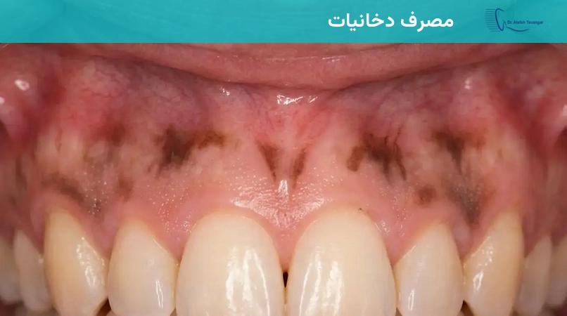 مصرف دخانیات