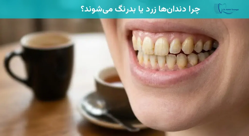 چرا دندانها زرد یا بدرنگ میشوند؟
