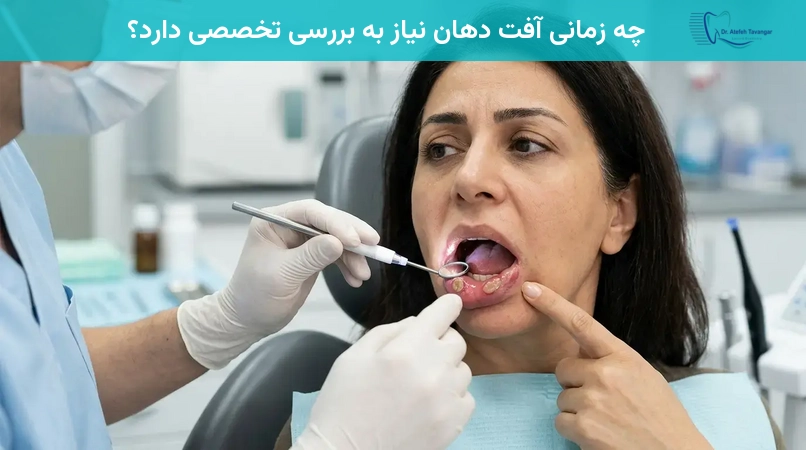 آفت دهانچه زمانی آفت دهان نیاز به بررسی تخصصی دارد؟