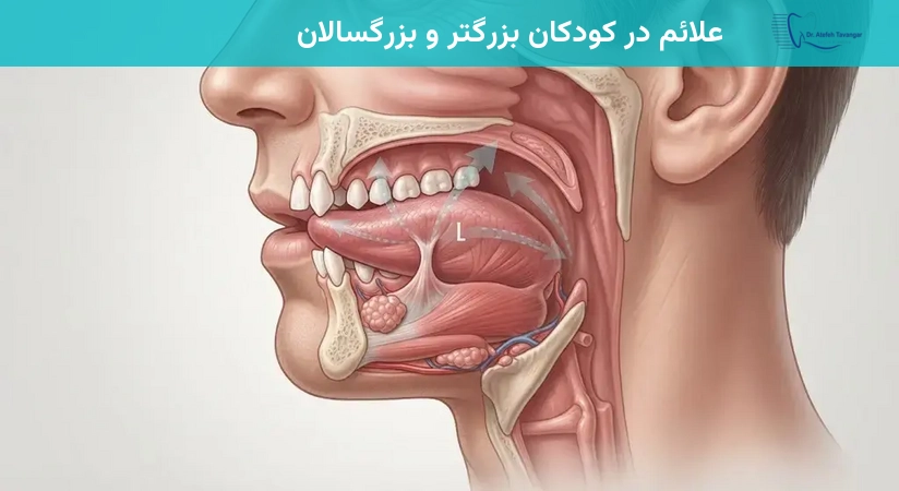 علائم در کودکان بزرگتر و بزرگسالان