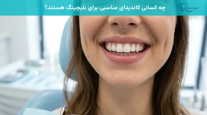 چه کسانی کاندیدای مناسبی برای بلیچینگ هستند؟