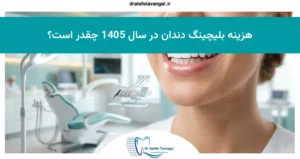 هزینه بلیچینگ دندان در سال 1405 چقدر است؟