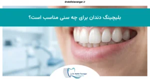بلیچینگ دندان برای چه سنی مناسب است؟