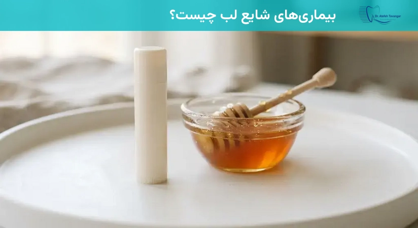 بیماریهای شایع لب چیست؟