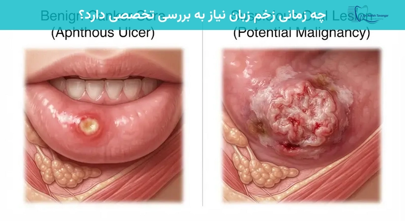چه زمانی زخم زبان نیاز به بررسی تخصصی دارد؟
