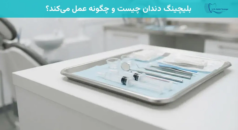 بلیچینگ دندان چیست و چگونه عمل میکند؟