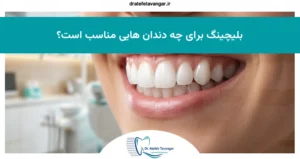 بلیچینگ برای چه دندان هایی مناسب است؟